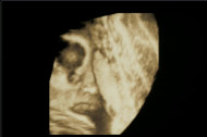 Фото УЗИ на 28 неделе беременности
