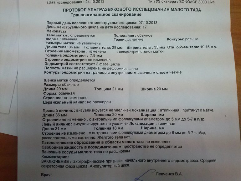 Боли в обоих боках...