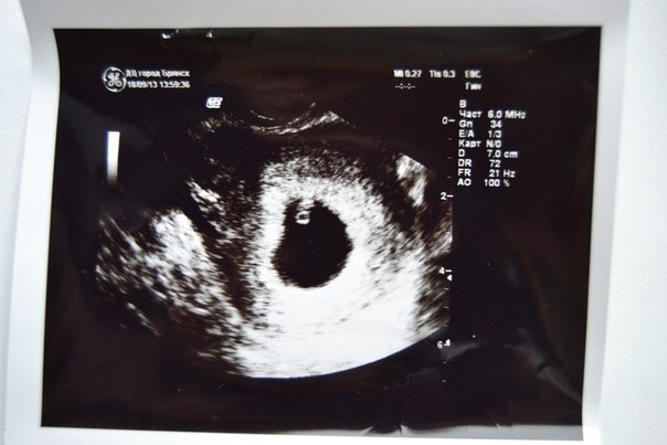 Начало второго чуда