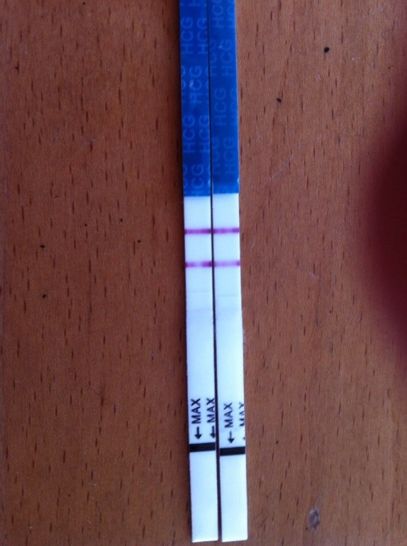 Рано радовалась... Подозрение на внематочную.