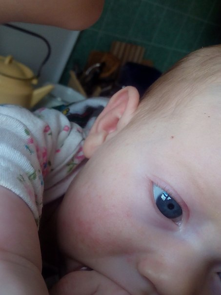 как быстро дейстует фенистил? Дубль 2 ))