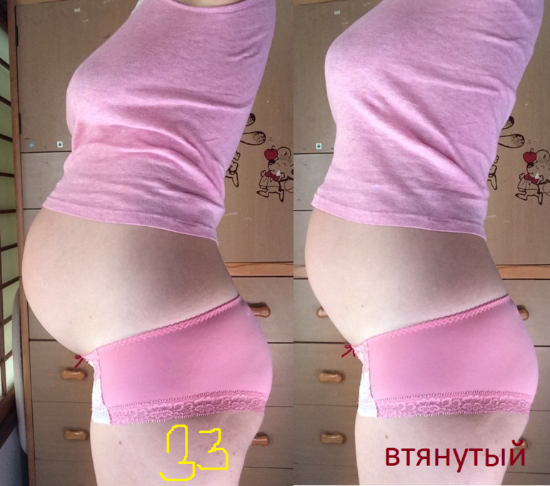 Втянуть живот в 33 недели)) — 27 ответов | форум Babyblog