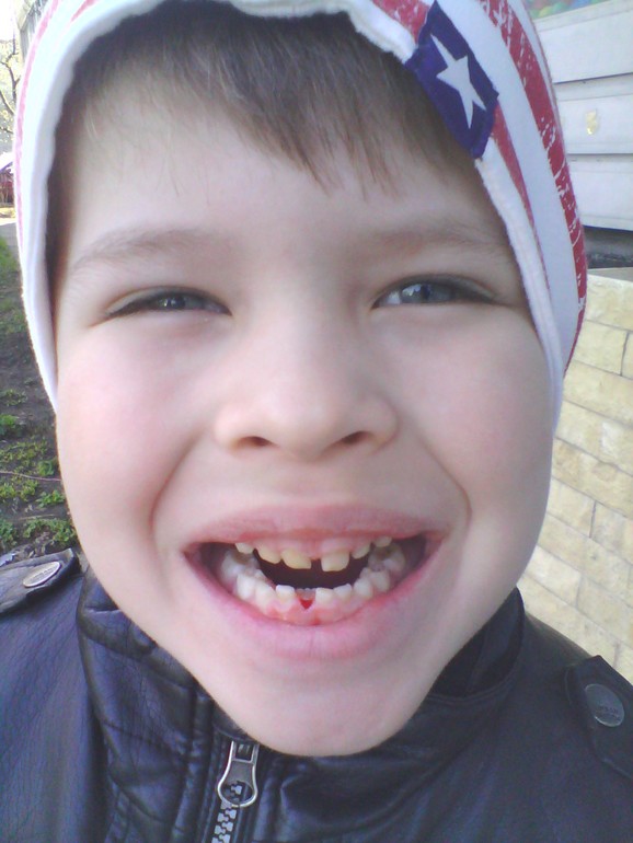 Первый поход к зубному