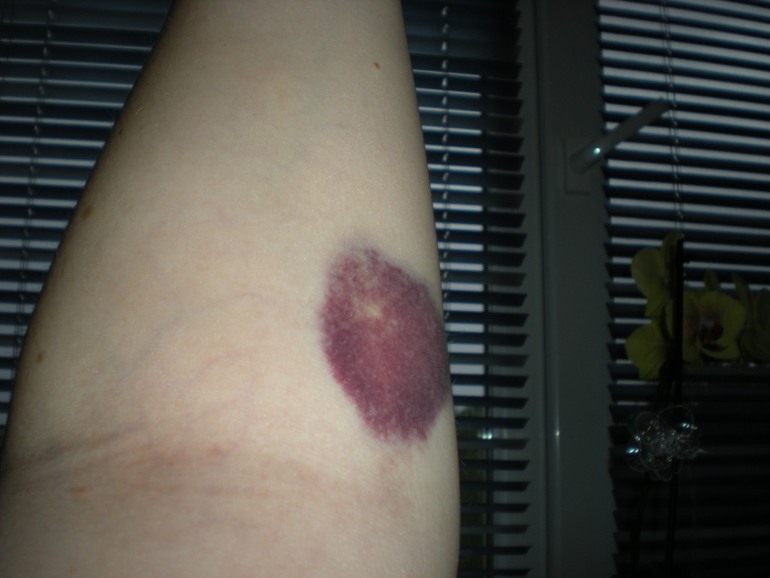 33-я неделька!+фото