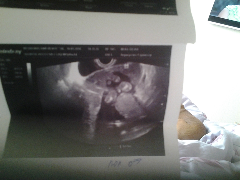 Тайна расскрыта!!!У нас будет....