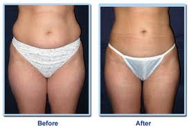 Простое решение больших проблем