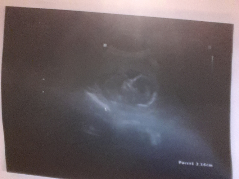 всем привет, а у нас будет мальчик, нам 17 неделик)))