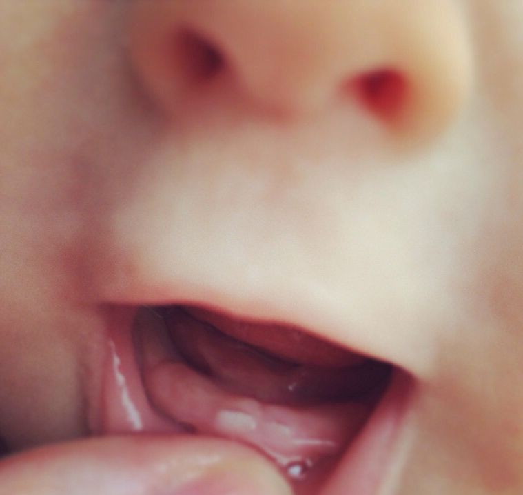 у нас второй зубик!