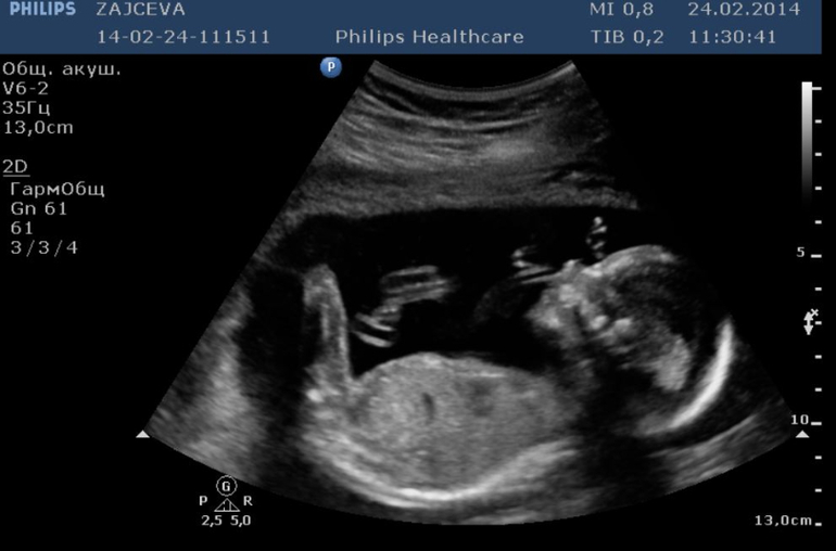 Наконец-то приветственный пост:)