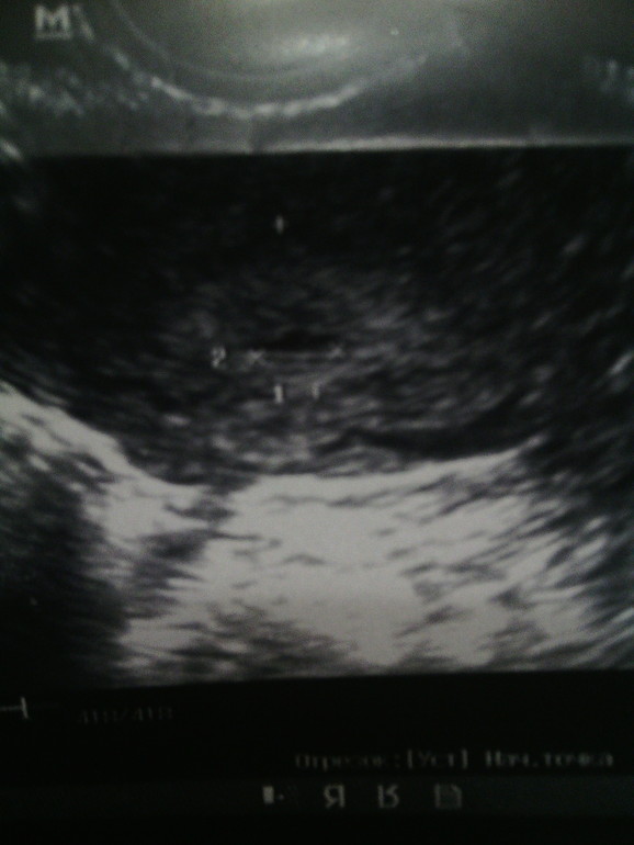 девчонки подскажите!!!!