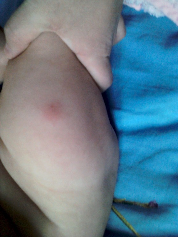 Поставили прививку