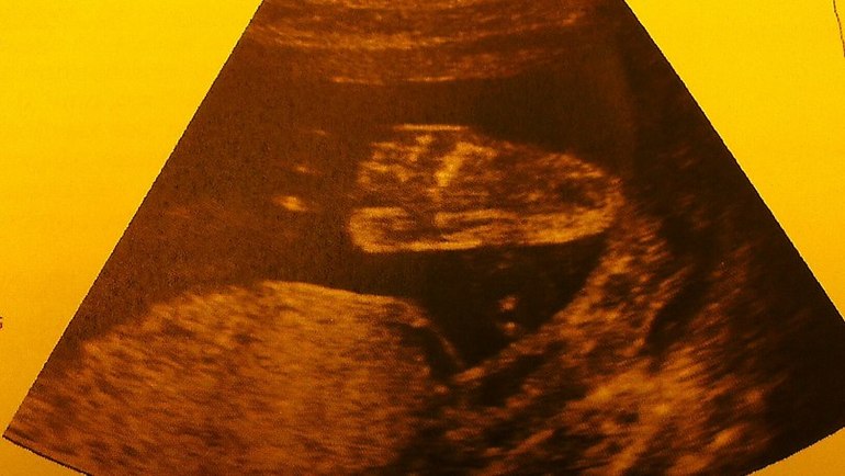 Ура! Узнали наконец-то кто в живоике живет!  :)