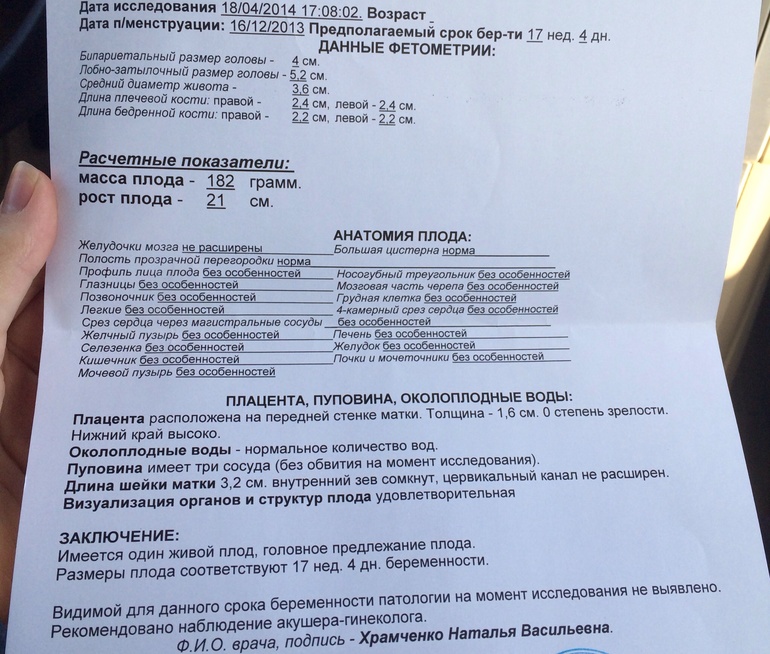 Прокомментируйте ,пожалуйста по длине ШМ