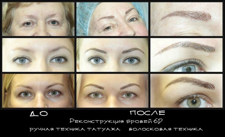 Реконструкция бровей 6D Brows