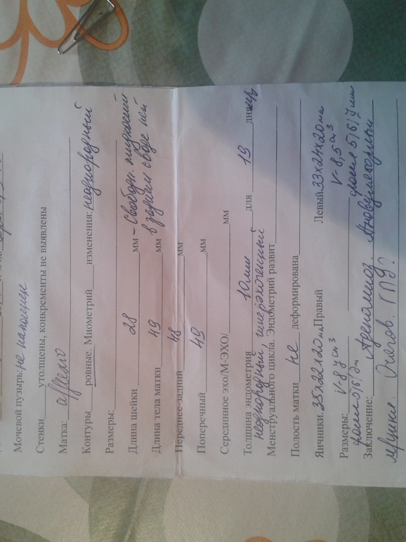 подскажите, в каком направлении идти