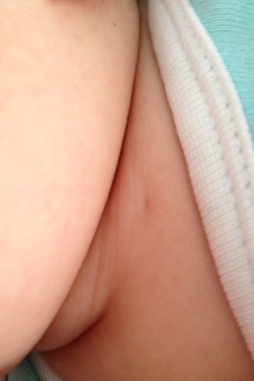 Что это такое? Какая-то штука на шее.