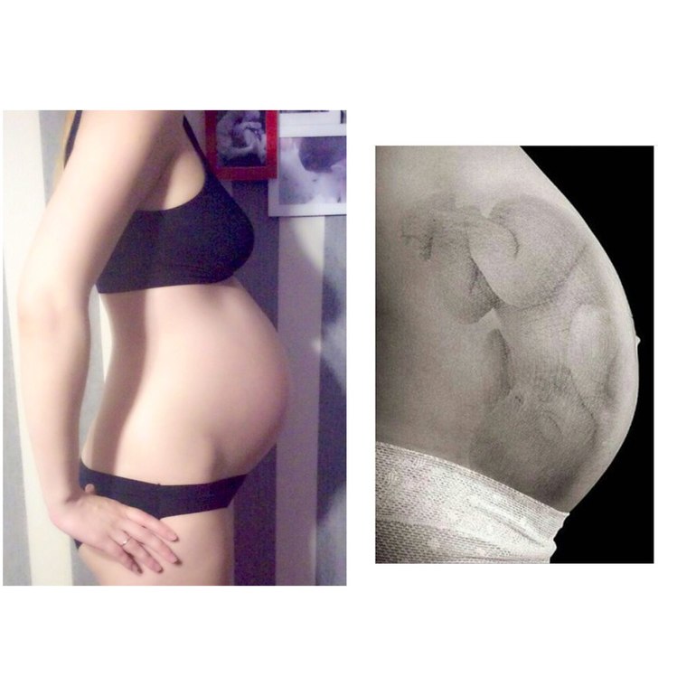 38 недель беременности сильно. Живот 32 неделе беременности беременности каменеет. Ребенок в животе 20 недель. Живот на 20 неделе. Живот на 20 неделе беременности.