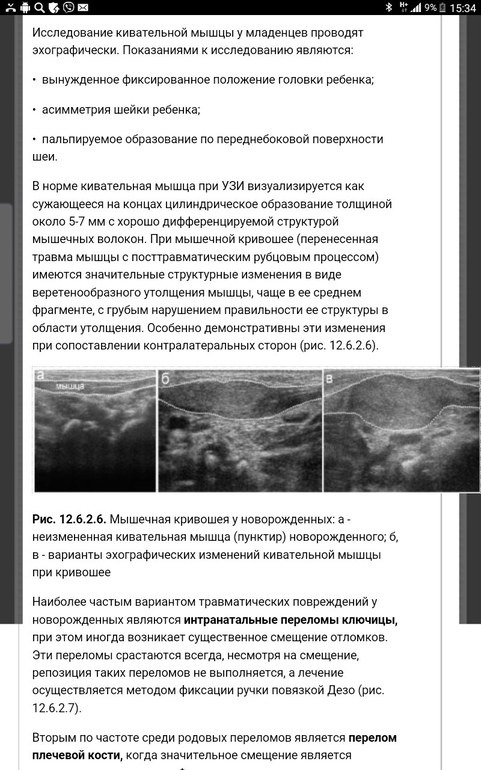 Кивательные мышцы у детей. Мышечная кривошея УЗИ протокол. УЗИ кивательных мышц протокол. Кивательные мышцы на УЗИ. Описание мышц на УЗИ.