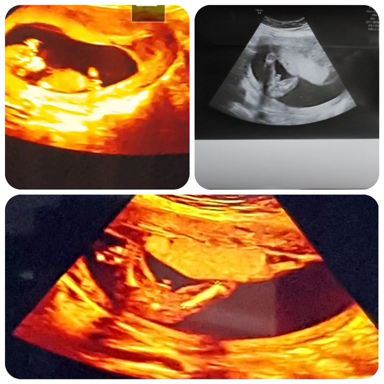 id1846905 (ирина) — дневник на Babyblog.ru