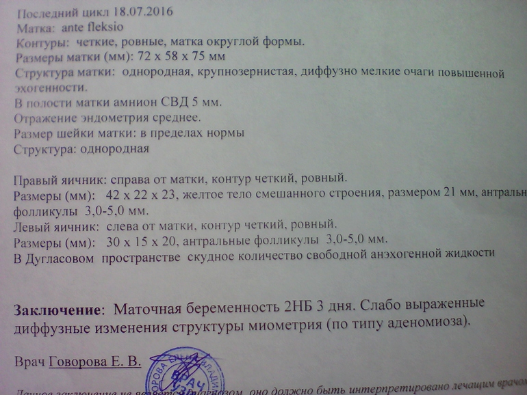 Фото результатов узи беременности Первое УЗИ))) 5 неделек акушерских)) форум Babyblog