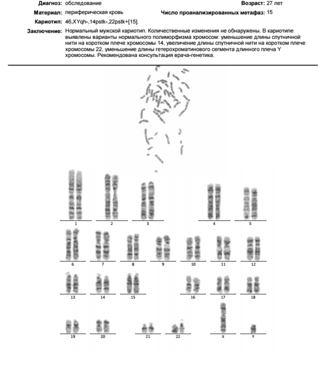 Кариотип анализ для чего. Кариотип пример результата анализа. Анализ кариотипа заключение нормальный женский кариотип. Кариотип заключение генетика. Результат анализа крови на кариотип.
