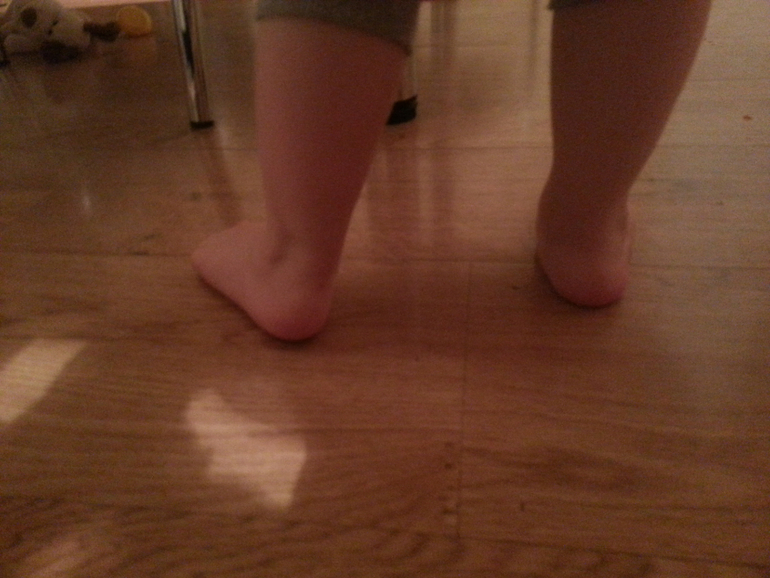 этот чёртов вальгус стоп(