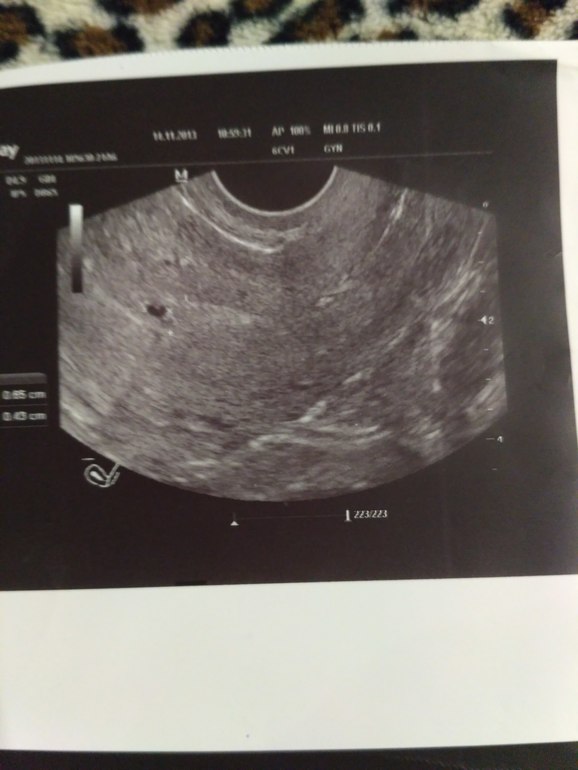 Неделя от зачатия форум. УЗИ 2 недели беременности. УЗИ 2 недели от зачатия. Эхоскопия 2 недели беременности.