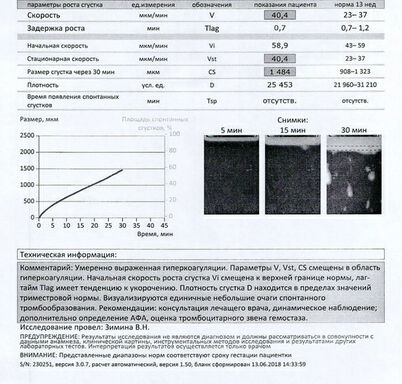 Тромбодинамика инвитро. Тромбодинамика показатели. Исследование тромбодинамики расшифровка. Анализ Тромбодинамика при беременности. Тромбодинамика норма.