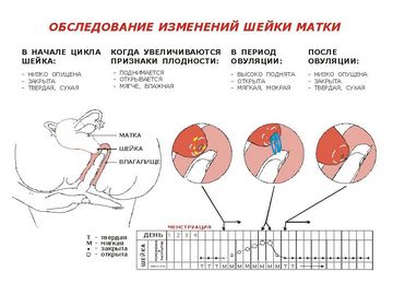 Рак влагалища - симптомы, признаки, диагностика и лечение