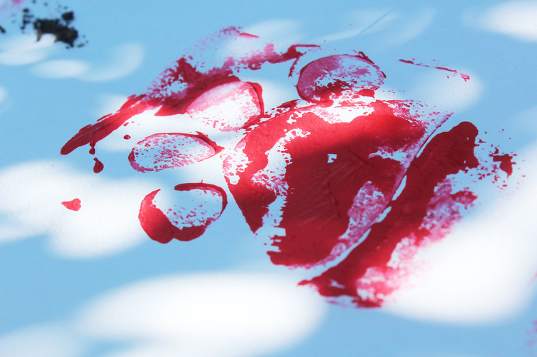 Девочка с тигриными следами