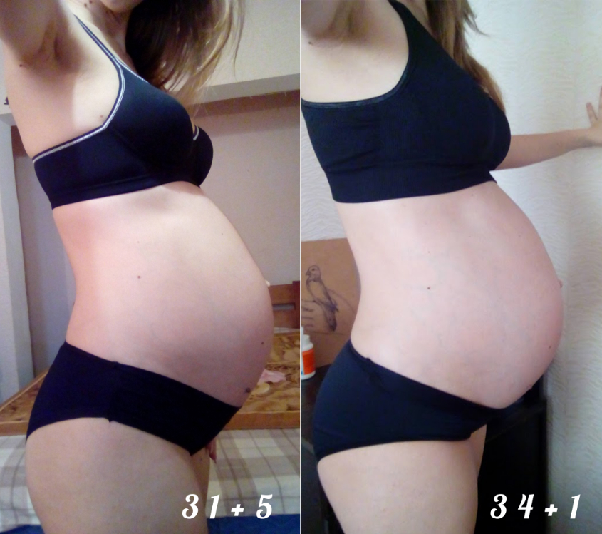 31+34