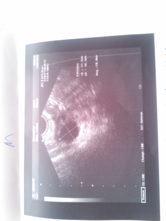 В поисках овуляции!!!