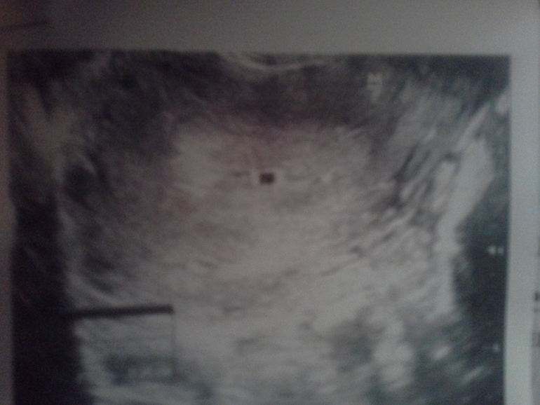 вот мое узи