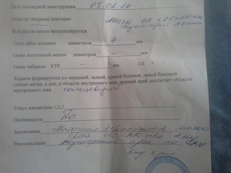 вот мое узи