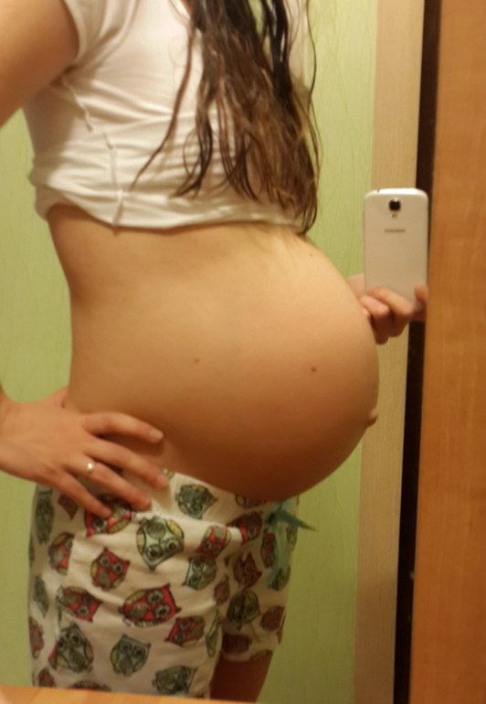 Отчет из ЖК в 34-35 недель