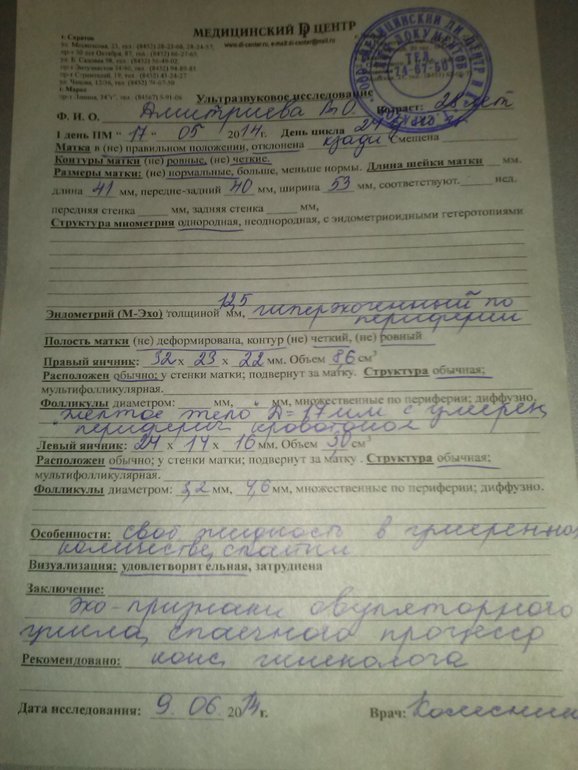 вправте мне мозги!!!)