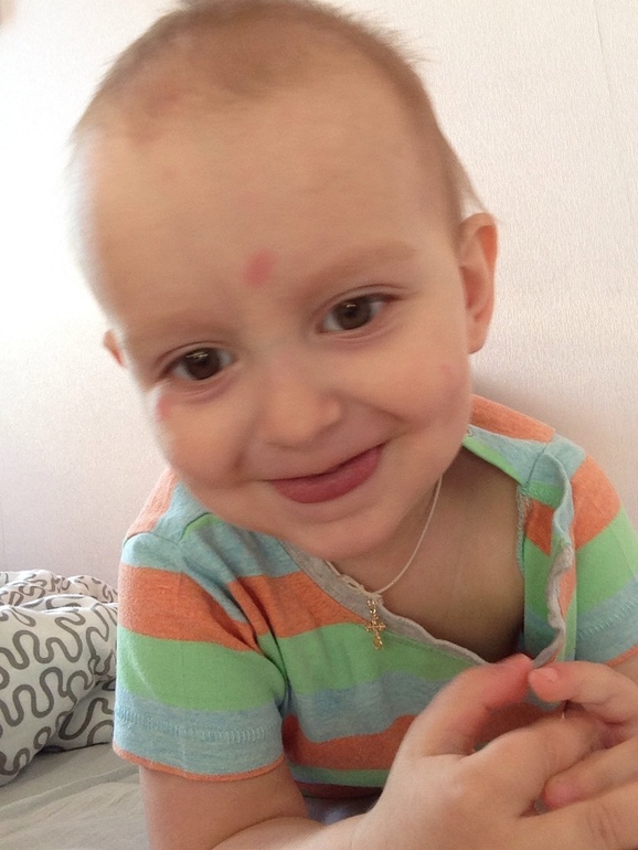 Что это за пятна?