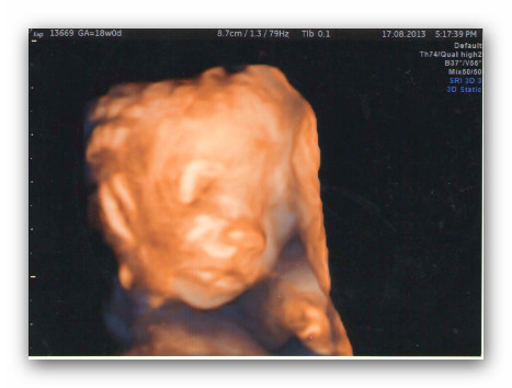 3D узи. Есть сходство?:)