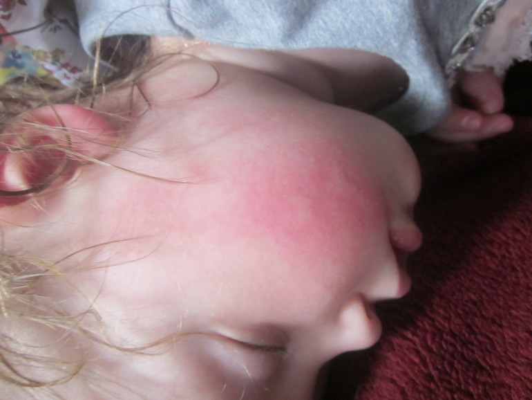 Девочки,что это может быть?