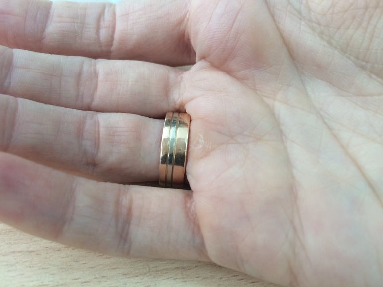 Золотое кольцо оставляет черные следы. Потемнения от кольца. Обручальные кольца с полосами. Почернело кольцо. Золотое кольцо потемнело.