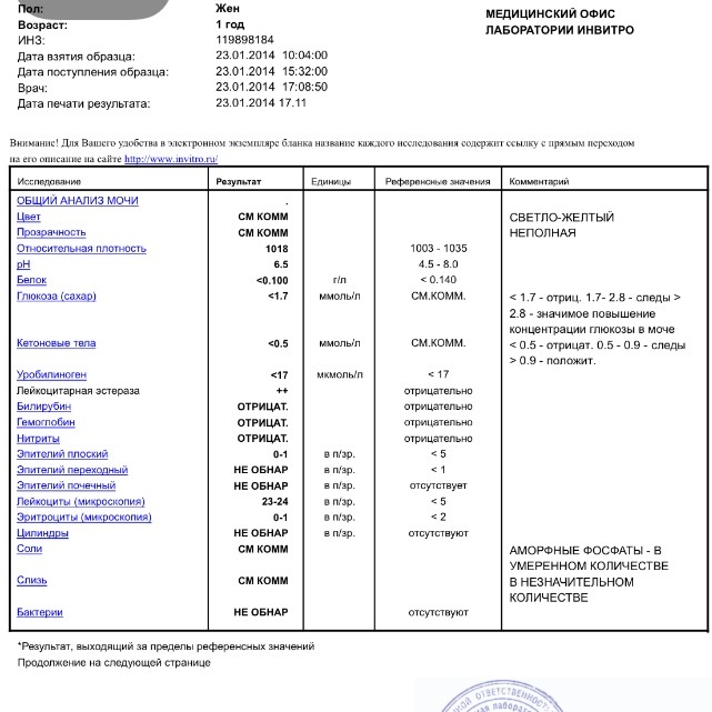 Анализ мочи-инфекция