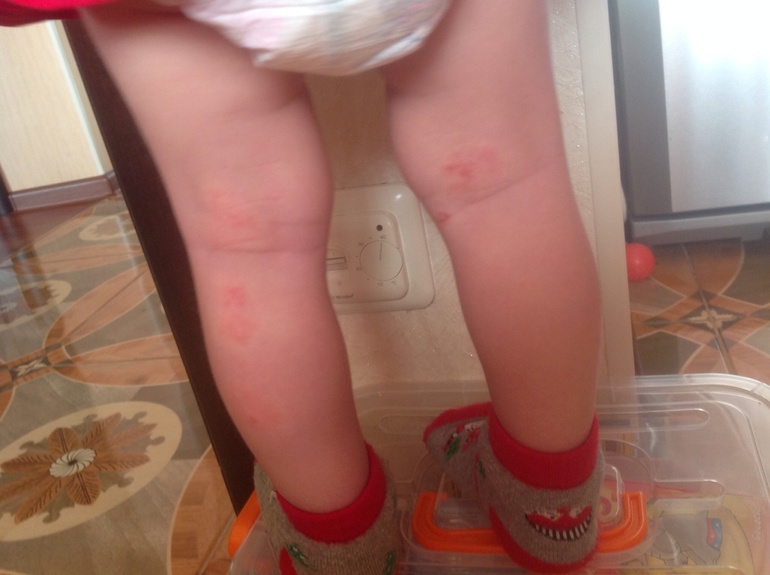 Человеческий организм - загадка))