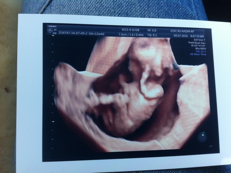 Узи 1 триместра!!