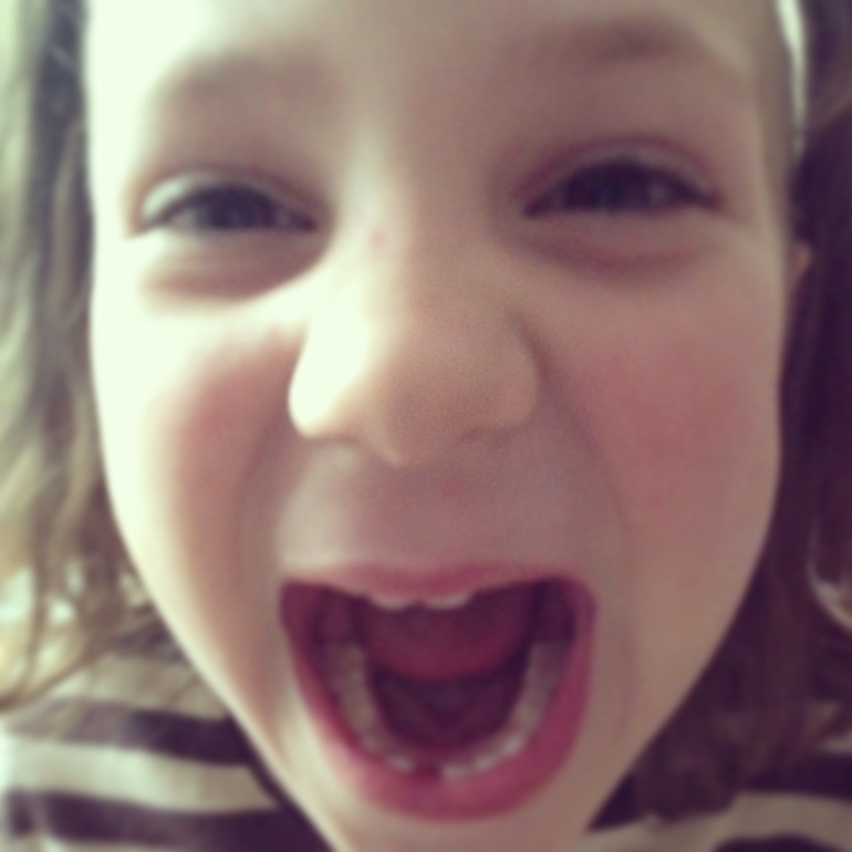 Потеряли зуб