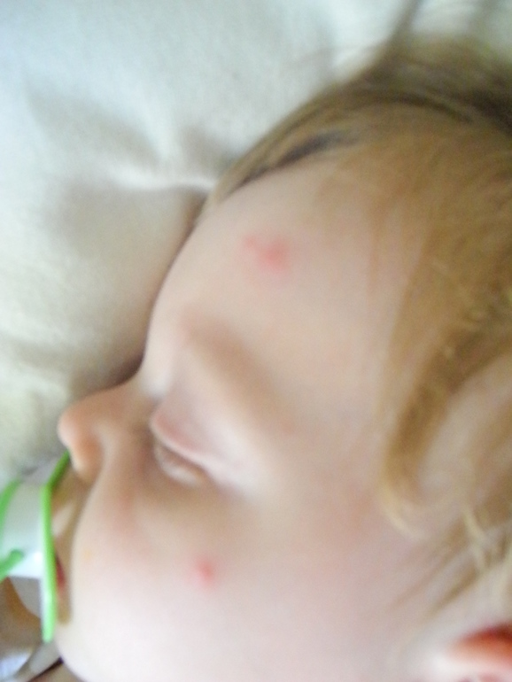 Комары или нет?