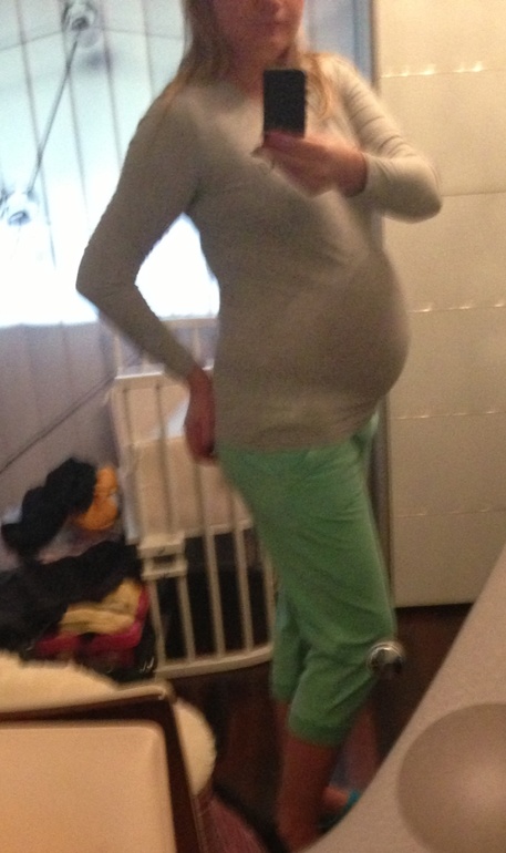 Девочки, вот во что превратились мои ноги...отеки, отеки...