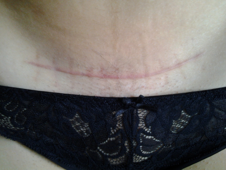 Спасибо тебе, о великий и могучий Контрактубекс!