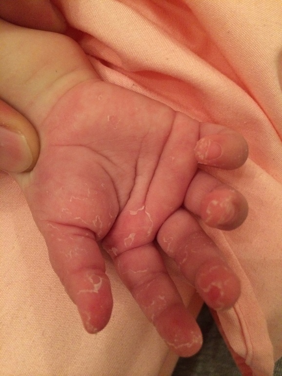 Уже второй пост,что же с ручками нашими?