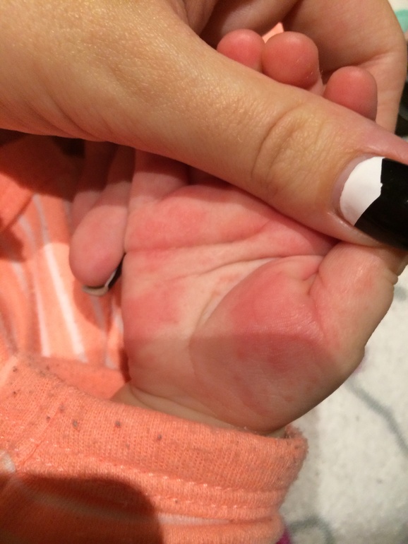 Уже второй пост,что же с ручками нашими?