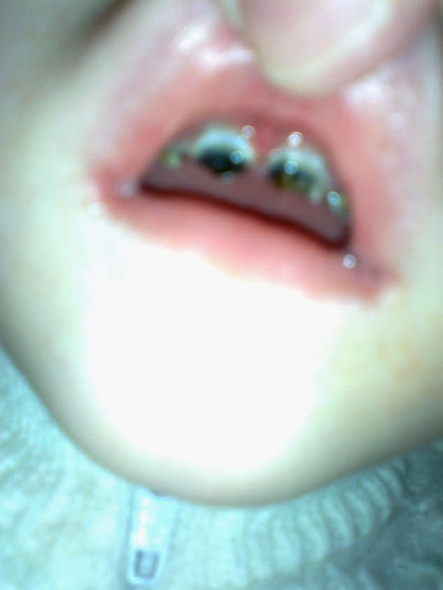 Спасти зубки